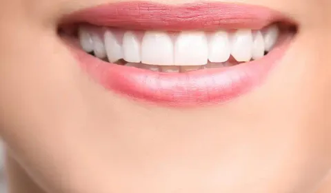 Dental Bonding
