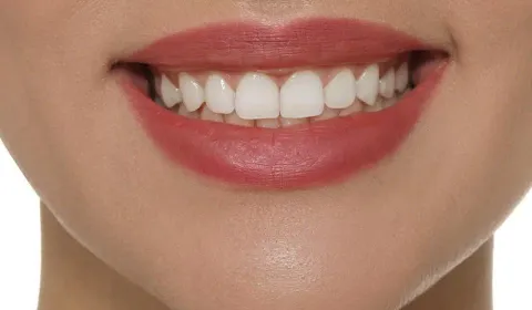 Smile Design