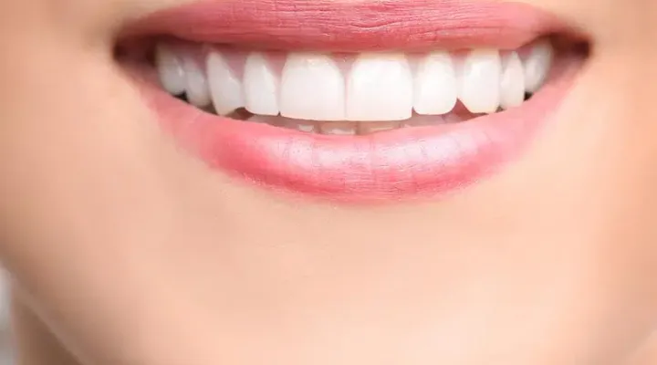 Dental Bonding