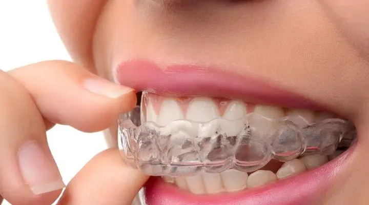 Invisalign