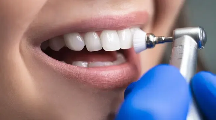 Teeth Cleaning